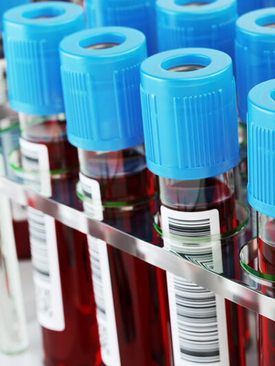 A group of blood test tubes.