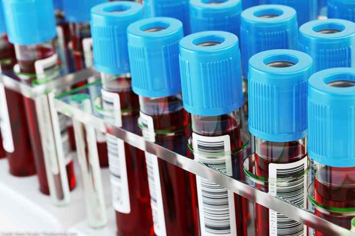 A group of blood test tubes.