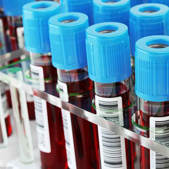 A group of blood test tubes.